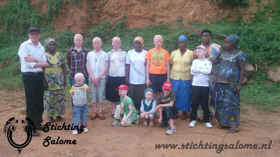 stichtingsalome-Albino kinderen 6.jpg