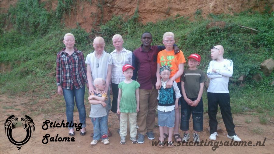 stichtingsalome-Albino kinderen 7.jpg